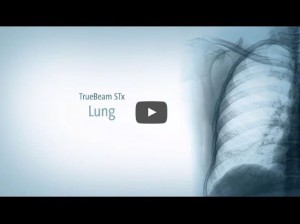 Lung Cancer Treatment - TrueBeam STx