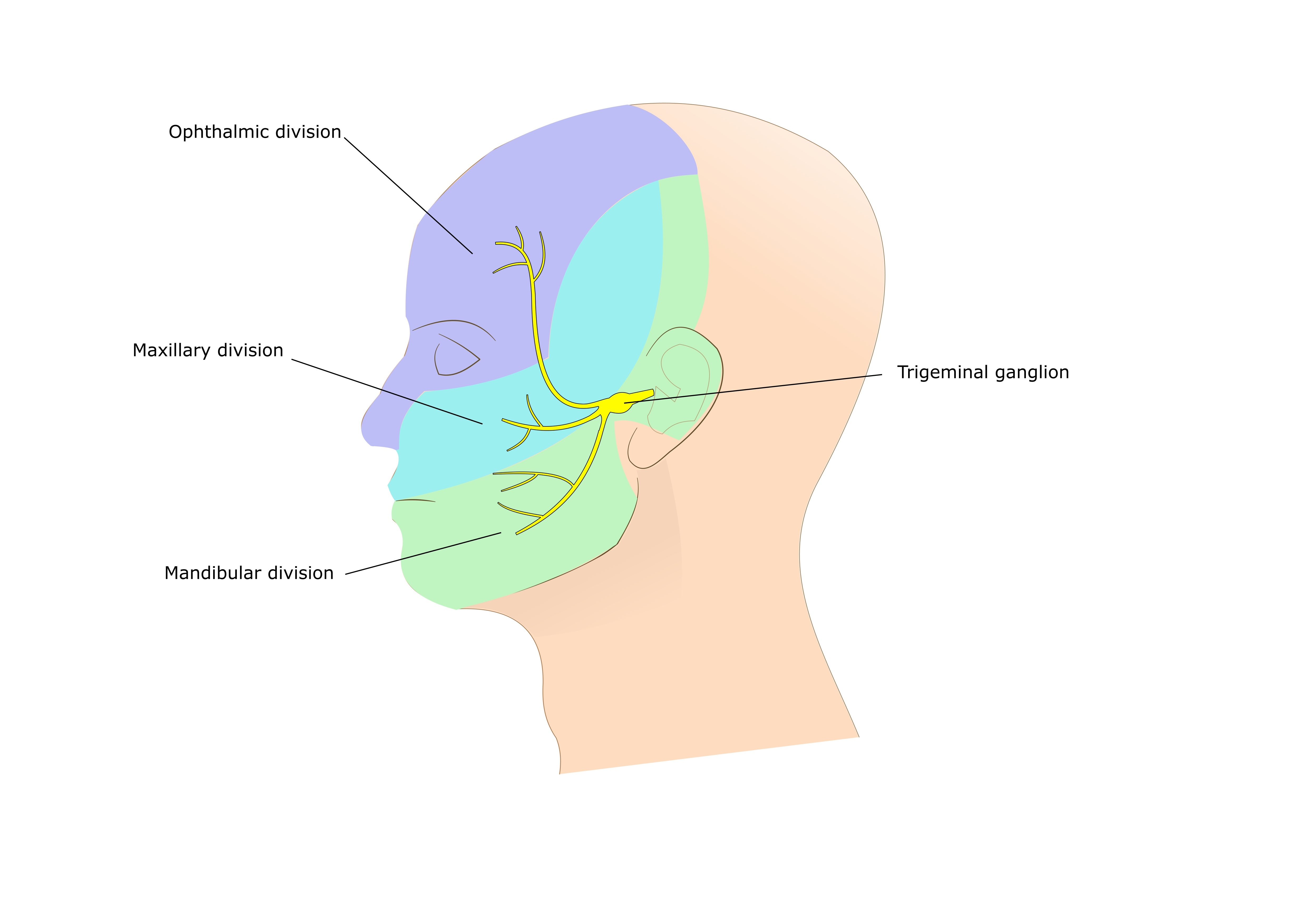 trigeminal-neuralgia-treatment-phoenix-cyberknife-center