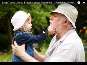 Brain Tumor Video - Phoenix CyberKnife