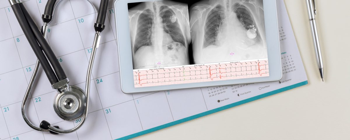 How Is Lung Cancer Diagnosed: What to Expect