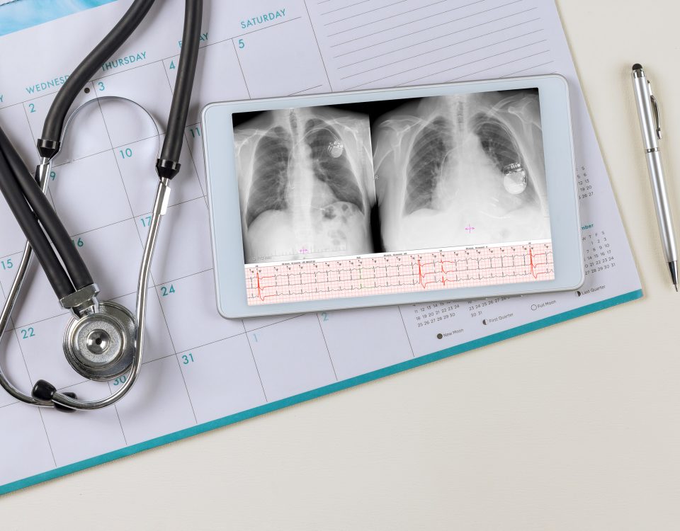 How Is Lung Cancer Diagnosed: What to Expect